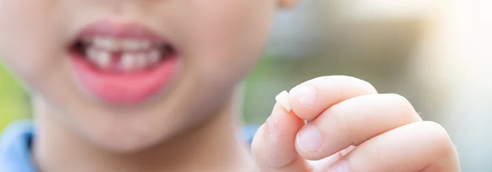 Losing Baby Teeth in Riverside CA